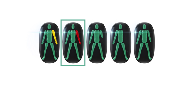 Classificação Funcional Desportiva | Episódio 07